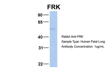 FRK Rabbit Polyclonal Antibody