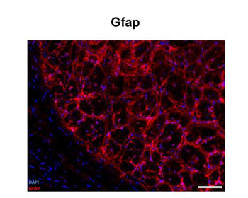 Gfap Rabbit Polyclonal Antibody