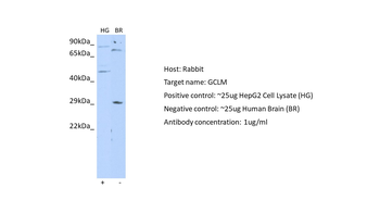 GCLM Rabbit Polyclonal Antibody