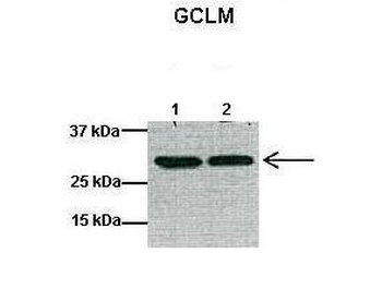 GCLM Rabbit Polyclonal Antibody