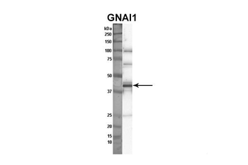 GNAI1 Rabbit Polyclonal Antibody
