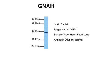 GNAI1 Rabbit Polyclonal Antibody