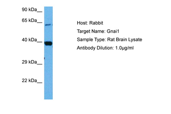 GNAI1 Rabbit Polyclonal Antibody