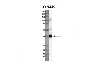 GNAI2 Rabbit Polyclonal Antibody