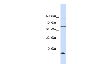 HSPE1 Rabbit Polyclonal Antibody