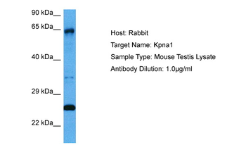 KPNA1 Rabbit Polyclonal Antibody
