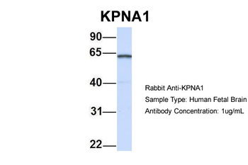 KPNA1 Rabbit Polyclonal Antibody