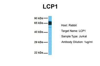 LCP1 Rabbit Polyclonal Antibody