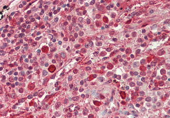 GBP2 Rabbit Polyclonal Antibody