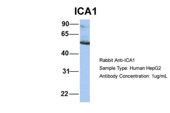 ICA1 Rabbit Polyclonal Antibody