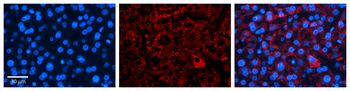 ICA1 Rabbit Polyclonal Antibody