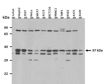 LDHA Rabbit Polyclonal Antibody