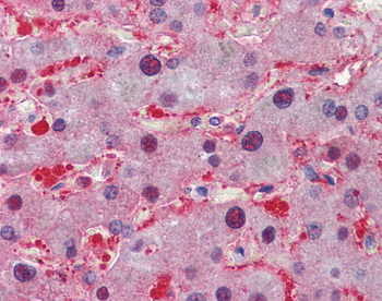 LDHA Rabbit Polyclonal Antibody