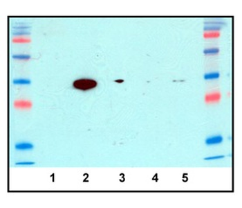 LDHA Rabbit Polyclonal Antibody
