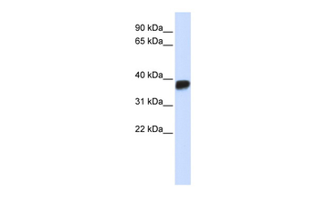 LDHA Rabbit Polyclonal Antibody