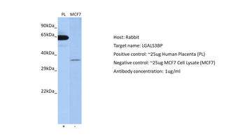 LGALS3BP Rabbit Polyclonal Antibody