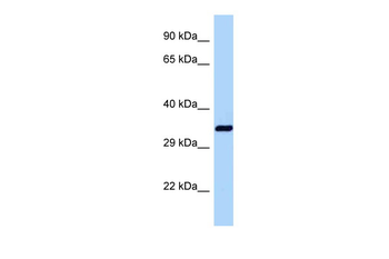 Dnajb1 Rabbit Polyclonal Antibody
