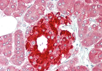 PHGDH Rabbit Polyclonal Antibody