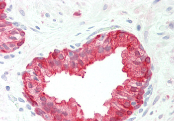 PHGDH Rabbit Polyclonal Antibody