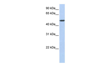 PHLDA1 Rabbit Polyclonal Antibody