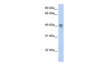 GNA12 Rabbit Polyclonal Antibody