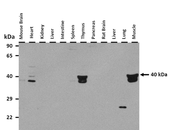 LGALS9 Rabbit Polyclonal Antibody