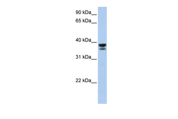 LGALS9 Rabbit Polyclonal Antibody