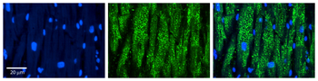 CCT5 Rabbit Polyclonal Antibody