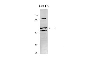 CCT5 Rabbit Polyclonal Antibody