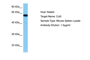 CCT5 Rabbit Polyclonal Antibody
