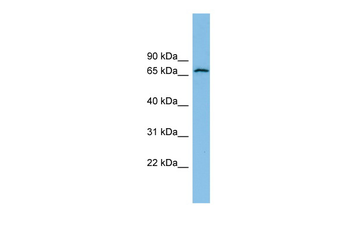 GLUD2 Rabbit Polyclonal Antibody