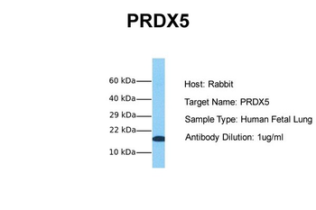 PRDX5 Rabbit Polyclonal Antibody