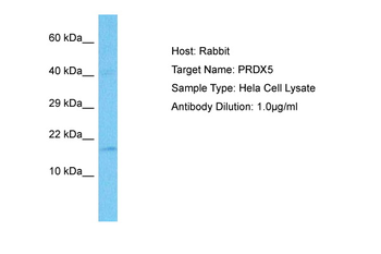 PRDX5 Rabbit Polyclonal Antibody