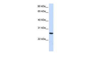 TTC33 Rabbit Polyclonal Antibody