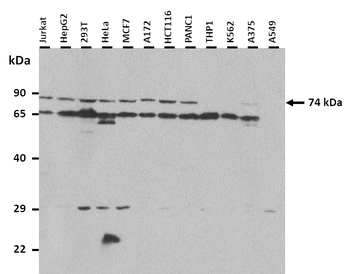 PADI4 Rabbit Polyclonal Antibody