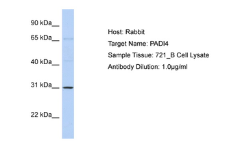 PADI4 Rabbit Polyclonal Antibody