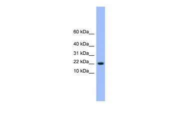 NXT1 Rabbit Polyclonal Antibody