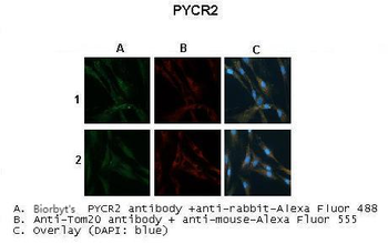 PYCR2 Rabbit Polyclonal Antibody
