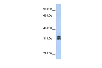 PYCR2 Rabbit Polyclonal Antibody