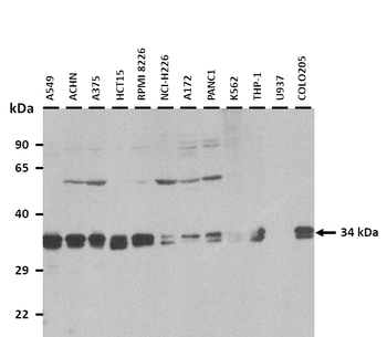PYCR2 Rabbit Polyclonal Antibody