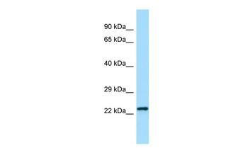 Chmp2b Rabbit Polyclonal Antibody