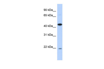 NOB1 Rabbit Polyclonal Antibody