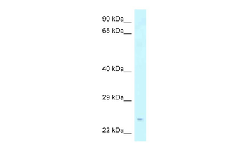 Stxbp6 Rabbit Polyclonal Antibody