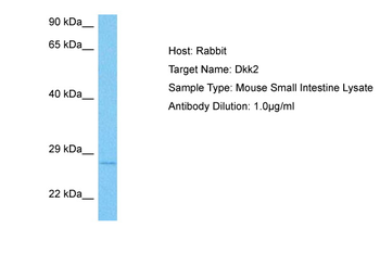 DKK1 Rabbit Polyclonal Antibody