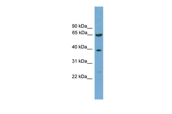 KLHL20 Rabbit Polyclonal Antibody