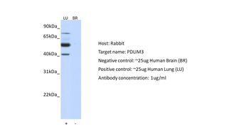 PDLIM3 Rabbit Polyclonal Antibody