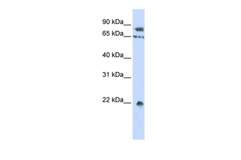 SENP1 Rabbit Polyclonal Antibody