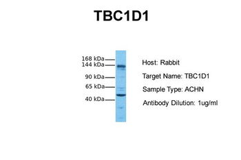 TBC1D1 Rabbit Polyclonal Antibody