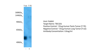 TBC1D1 Rabbit Polyclonal Antibody