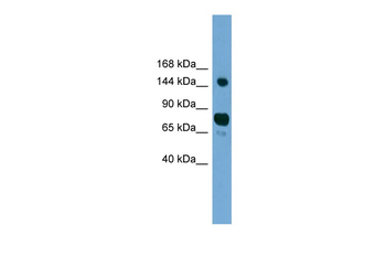 AGTPBP1 Rabbit Polyclonal Antibody